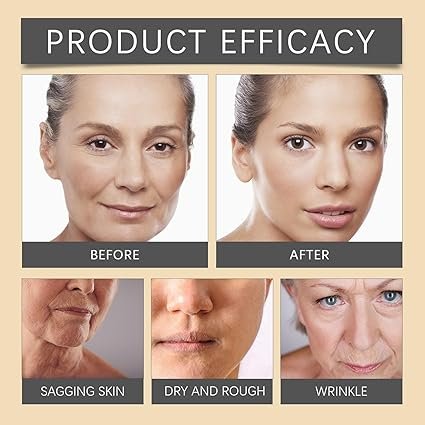 OUHOE Bee Venom Wrinkle Cream 20g anti-aging facial moisturizer for hydrated and smoother-looking skin — image 2