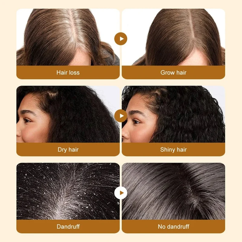 SAUVASINE Batana Hair Oil 120ml nourishing hair and scalp oil for stronger, smoother and healthier-looking hair — image 4