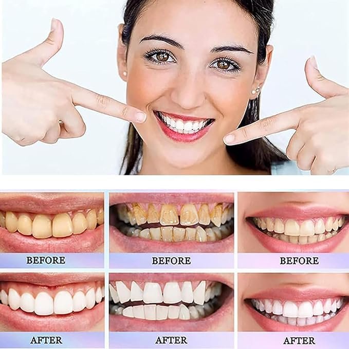Oralhoe Nicotinamide Dazzle White Toothpaste 100g whitening gel toothpaste with Vitamin B3 for daily oral care. — image 3