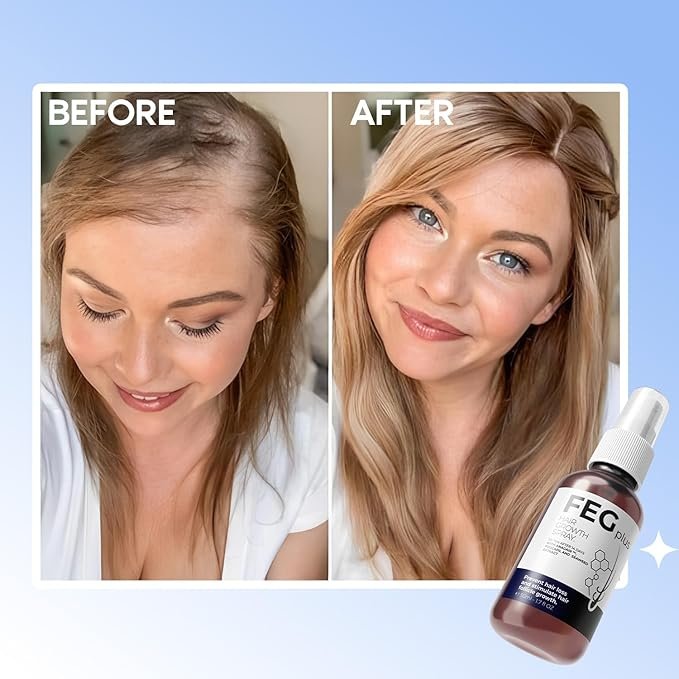 FEG Plus Hair Growth Spray 50ml for scalp care and healthier-looking, fuller hair. — image 5