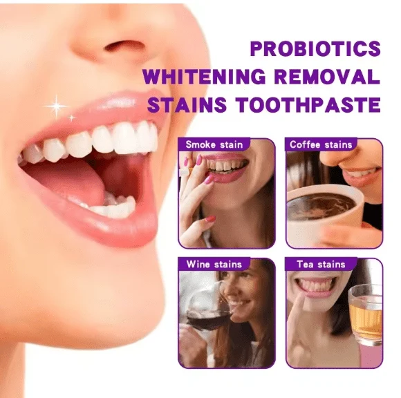 Deep Clean Whitening Toothpaste 120g for plaque removal, fresh breath and daily oral hygiene care — image 4