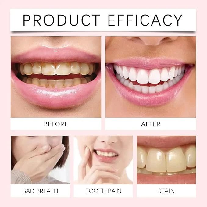 Oralhoe Nicotinamide Dazzle White Toothpaste 100g whitening gel toothpaste with Vitamin B3 for daily oral care. — image 4
