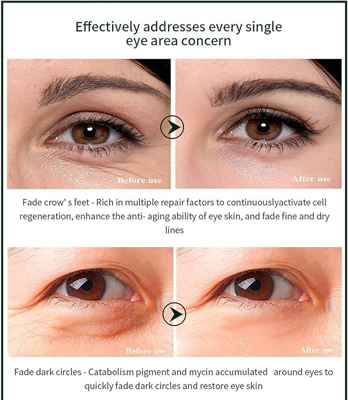 Time Eraser Eye Essence Oil 10ml for hydrating the under-eye area and reducing the appearance of fine lines — image 5