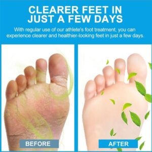 Sumifun - Foot Anti-Bacterial Cream